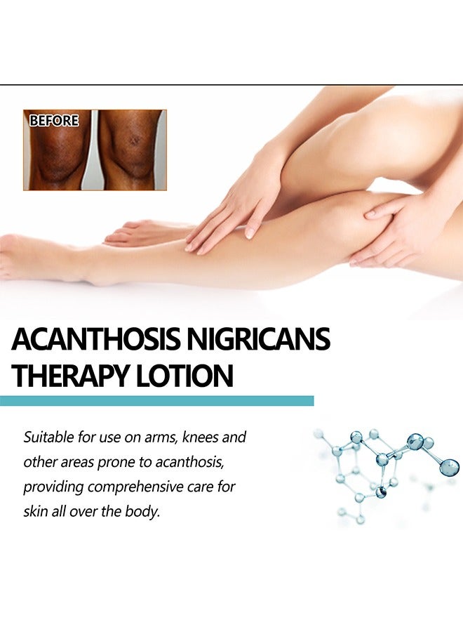 EELHOE Acanthosis Nigricans Therapy Lotion - with Lactic Acid ,Dermatologist Tested Retinol Lotion, Hyperpigmentation Removal Lotion, For Dark Body Parts like Neck Ankles Knuckles Armpits 30ml - Image 3