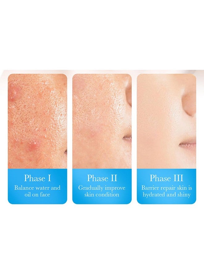 بيو أكوا قناع الوجه المهدئ والمصلح من بيواكوا بحمض الهيالورونيك وفيتامين ب5، مرطب ومغذي ومصلح لبشرة الوجه، 30 جم × 5 قطع - Image 5