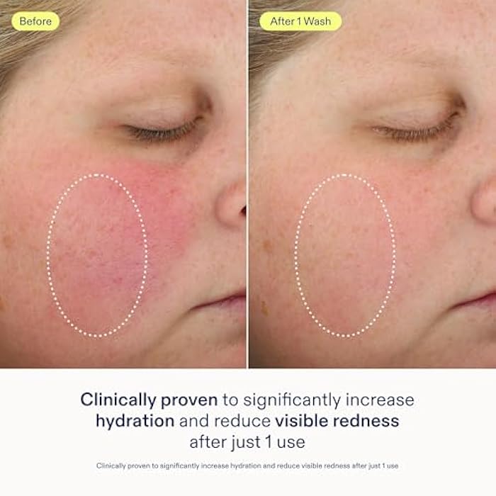 Skinfix Foaming Oil Cleanser for Face - 6 oz - Rich Gel-to-Foam Formula to Hydrate & Soothe Dry, Sensitive Skin - Fragrance Free, Vegan, Cruelty Free - Image 3