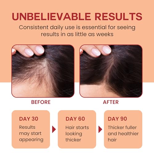 Lebanta Raw Batana Oil for Hair Growth - 100% Pure, Organic 4oz Batana from Honduras for Thick and Strong Natural Hair - Dr. Sebi Unrefined Cold Pressed Cosmetic Scalp Mask Gifts for Women (1 Pack) - Image 3