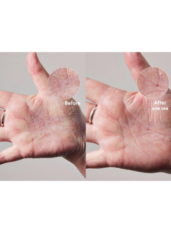 لانو ليبس كريم لانوليبس ١٠١ الفائق للبشرة الجافة - كريم للجسم ومرطب للوجه - زبدة للجسم مخفوقة للبشرة الجافة - غني باللانولين الثلاثي وزيت اللوز الحلو وزبدة الشيا وفيتامين هـ للعناية بالجسم (٢٫٠٢ أونصة) - Image 2