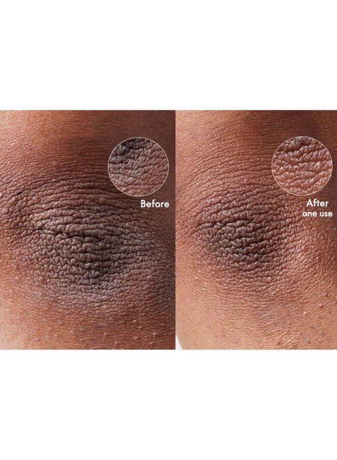 لانو ليبس كريم لانوليبس ١٠١ الفائق للبشرة الجافة - كريم للجسم ومرطب للوجه - زبدة للجسم مخفوقة للبشرة الجافة - غني باللانولين الثلاثي وزيت اللوز الحلو وزبدة الشيا وفيتامين هـ للعناية بالجسم (٢٫٠٢ أونصة) - Image 4