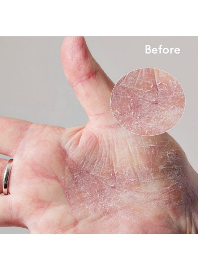 لانو ليبس كريم لانوليبس ١٠١ الفائق للبشرة الجافة - كريم للجسم ومرطب للوجه - زبدة للجسم مخفوقة للبشرة الجافة - غني باللانولين الثلاثي وزيت اللوز الحلو وزبدة الشيا وفيتامين هـ للعناية بالجسم (٢٫٠٢ أونصة) - Image 3