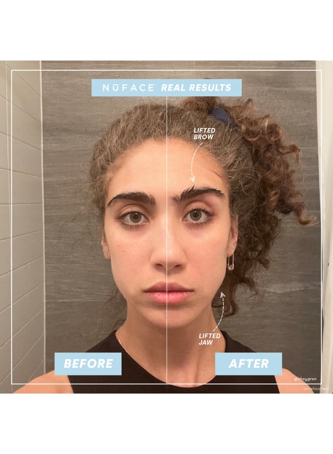 Nuface Mini Facial Toning Device Includesl Gel Primer - Image 4