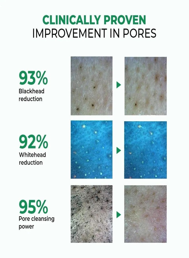 Conscious Chemist® Zero Pore Ultra Light Oil Cleanser | 60ml | Pore Cleansing & Oil Control Face Cleanser with LHA, Niacinamide & Panthenol | Unclogs Pores, Refines Texture | For Men & Women, All Skin Types - Image 5