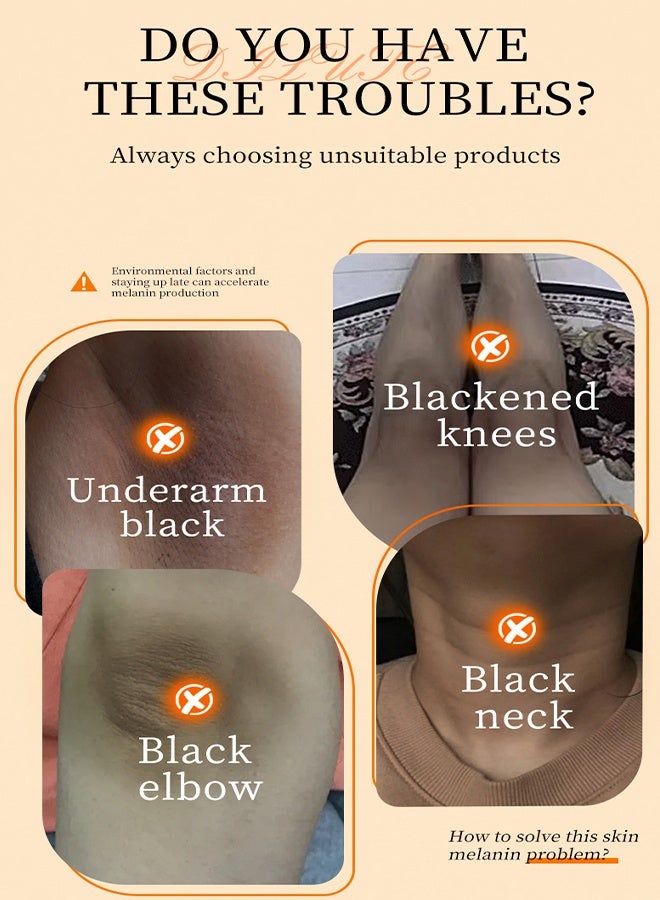 مويكا كريم مصحح البقع الداكنة ، مزيل البقع الداكنة للرقبة تحت الإبط ، الإبط ، المرفقين ، الركبتين ، تفتيح وترطيب الجسم نتيجة فورية 60 مل - Image 5