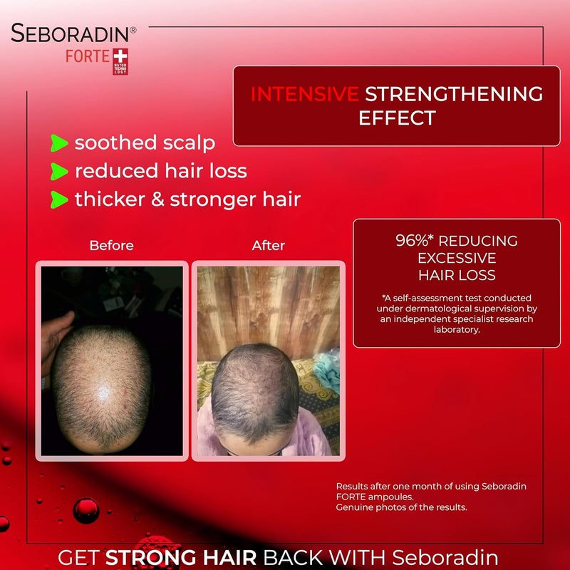 Seboradin Leave In Conditioner Hair Spray Alcoholfree Siliconefree Strengthening Moistruizing Detangling Forte 200 ml - Image 1