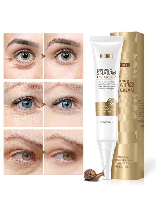 لايكو كريم العين الحلزون الجينسنغ ، يزيل الهالات السوداء مصل العيون المضاد للشيخوخة ، تأثير مرطب ومرطب للعناية بالبشرة تتفتح العيون ضيقة وأكثر ثباتا ينظف بلطف ويزيل الأوساخ الزيوت 30 جرام - Image 1