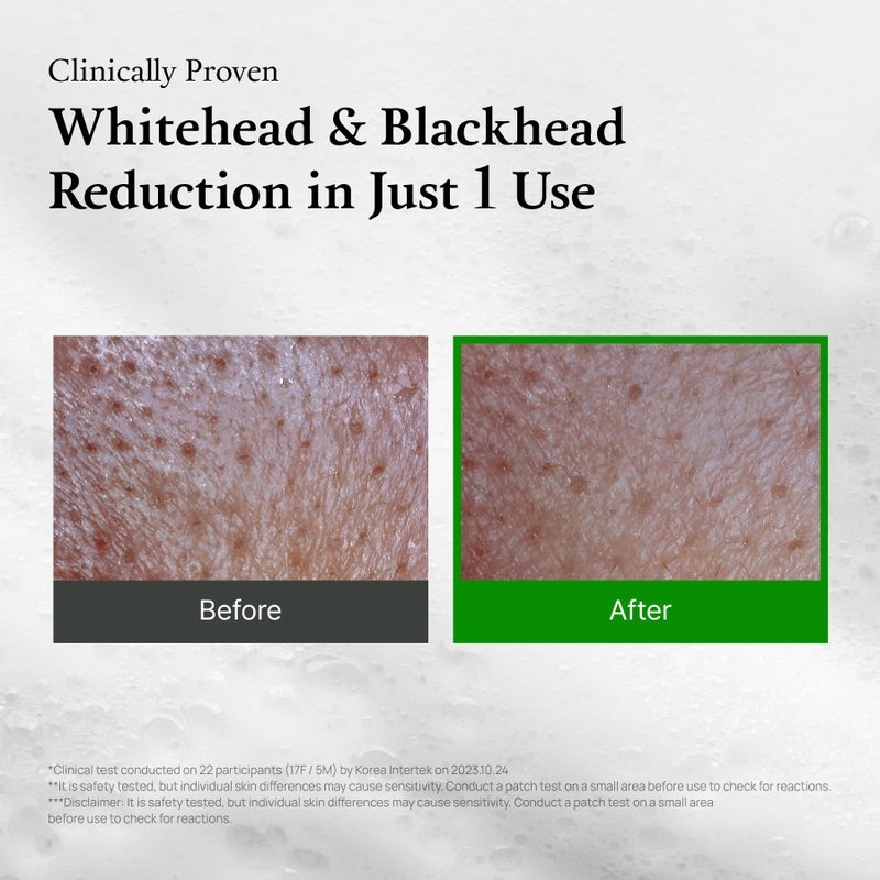 Fully قناع الطين الأخضر بالكامل من الطماطم، ينظف المسام ويطهرها مع 49% مستخلص الطماطم الأخضر، للعناية بالزيوت الزائدة والمسام المسدودة، تقشير، خالي من العطور، نباتي ومختبر جلدياً، 4.05 أونصة سائلة - Image 5