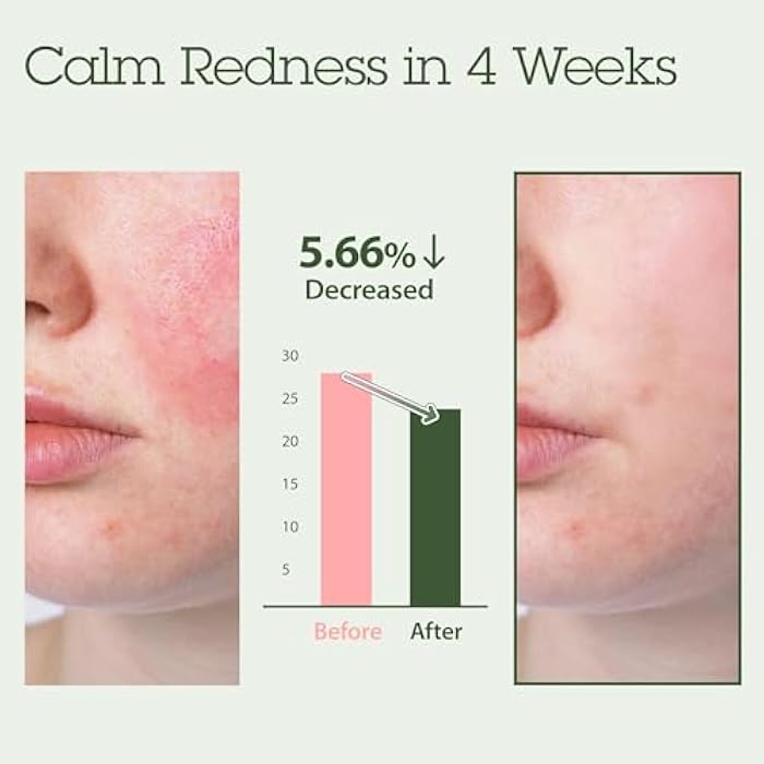 Blithe Korean Skin Care Products 6 Leaves Clear Essence for Rosacea & Redness Relief, BHA Toner Cooling Moisturizer for Face, Blackhead Treatment, Evening Primrose Wintergreen Green Tea 1.83 Oz - Image 3