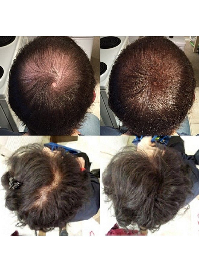 Nor1 Keratin Hair Building Fibers: Hair Fiber Filler And Thickener For Men And Women Cover Up And Concealer For Thinning Areas Or Minor Bald Spot Thicker Fuller Hair In Seconds 25 Grams - Image 3