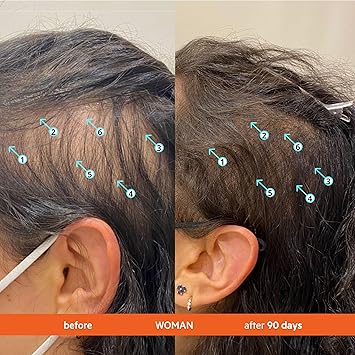 DS LABORATORIES Revita Conditioner for Thinning Hair by DS Laboratories Supports Hair Growth for Men and Women Volumizing Thickening and Strengthening Sulfate Free 7 Fl Oz 205mL Packaging May Vary - Image 5