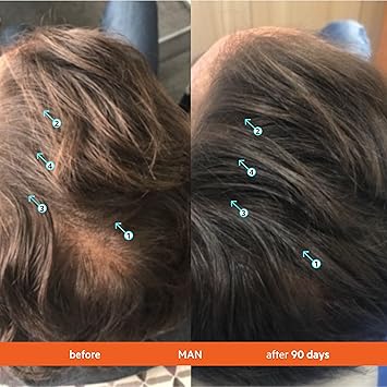 DS LABORATORIES Revita Conditioner for Thinning Hair by DS Laboratories Supports Hair Growth for Men and Women Volumizing Thickening and Strengthening Sulfate Free 7 Fl Oz 205mL Packaging May Vary - Image 4