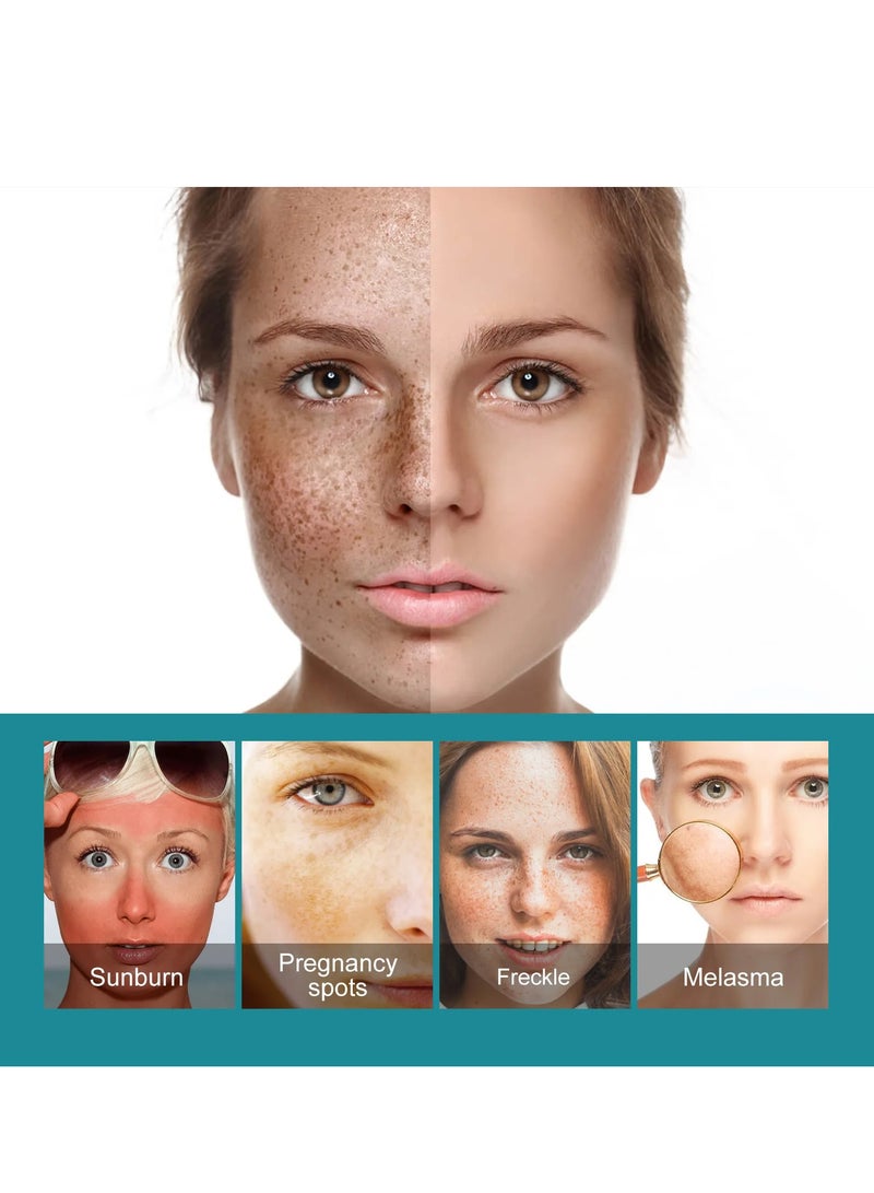 EELHOE Whitening Cream Dark Spots, Lightening, Freckles, Sun Spots Removal, Brighten Skin Tone, Melanin Corrector, Face Cream, 20ml - Image 4