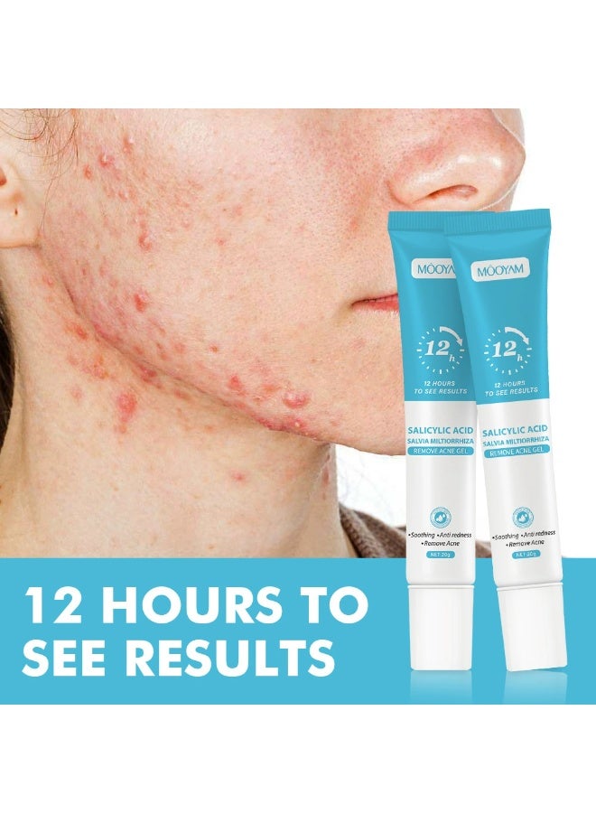 MOOYAM Salicylic Acid Remove Acne Treatment Gel 20g Rapid Action Acne Spot Treatment for Face Lightens Acne Marks Removes Acne and Shrinks Pores Fast Acne Removal for Face to Control and Clear Breakouts - Image 1