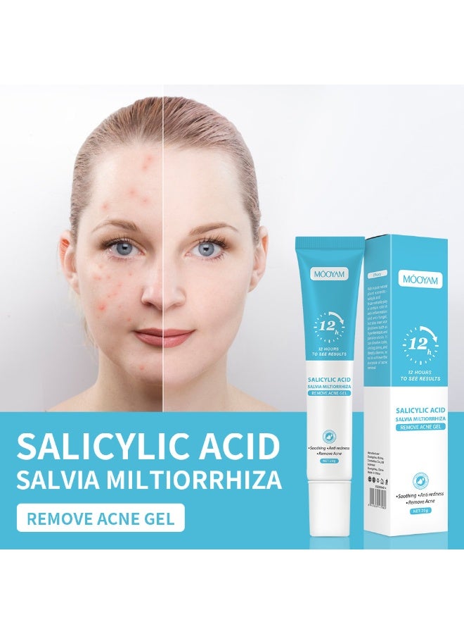 MOOYAM Salicylic Acid Remove Acne Treatment Gel 20g Rapid Action Acne Spot Treatment for Face Lightens Acne Marks Removes Acne and Shrinks Pores Fast Acne Removal for Face to Control and Clear Breakouts - Image 3