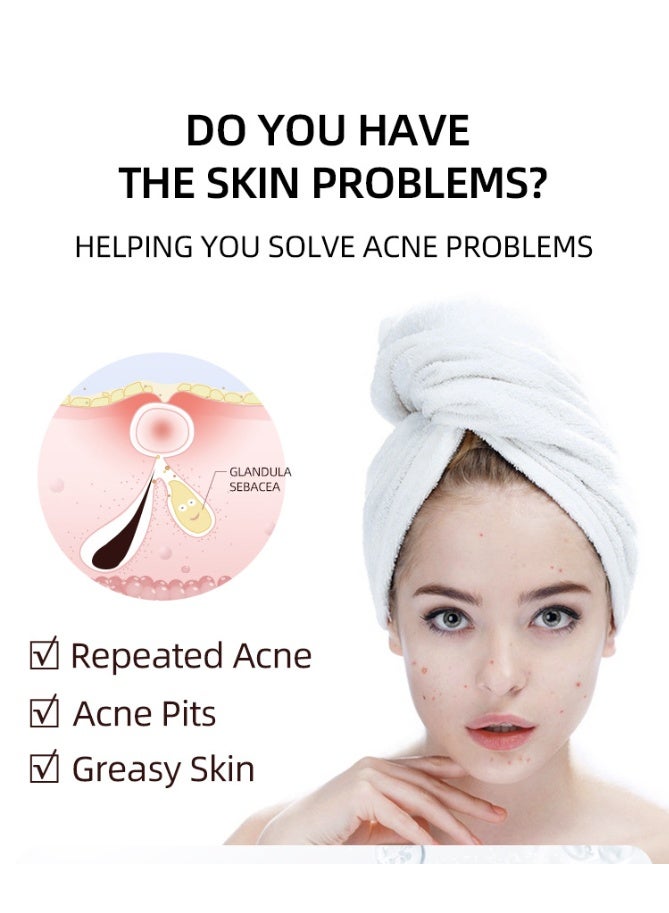 MOOYAM Salicylic Acid Remove Acne Treatment Gel 20g Rapid Action Acne Spot Treatment for Face Lightens Acne Marks Removes Acne and Shrinks Pores Fast Acne Removal for Face to Control and Clear Breakouts - Image 5