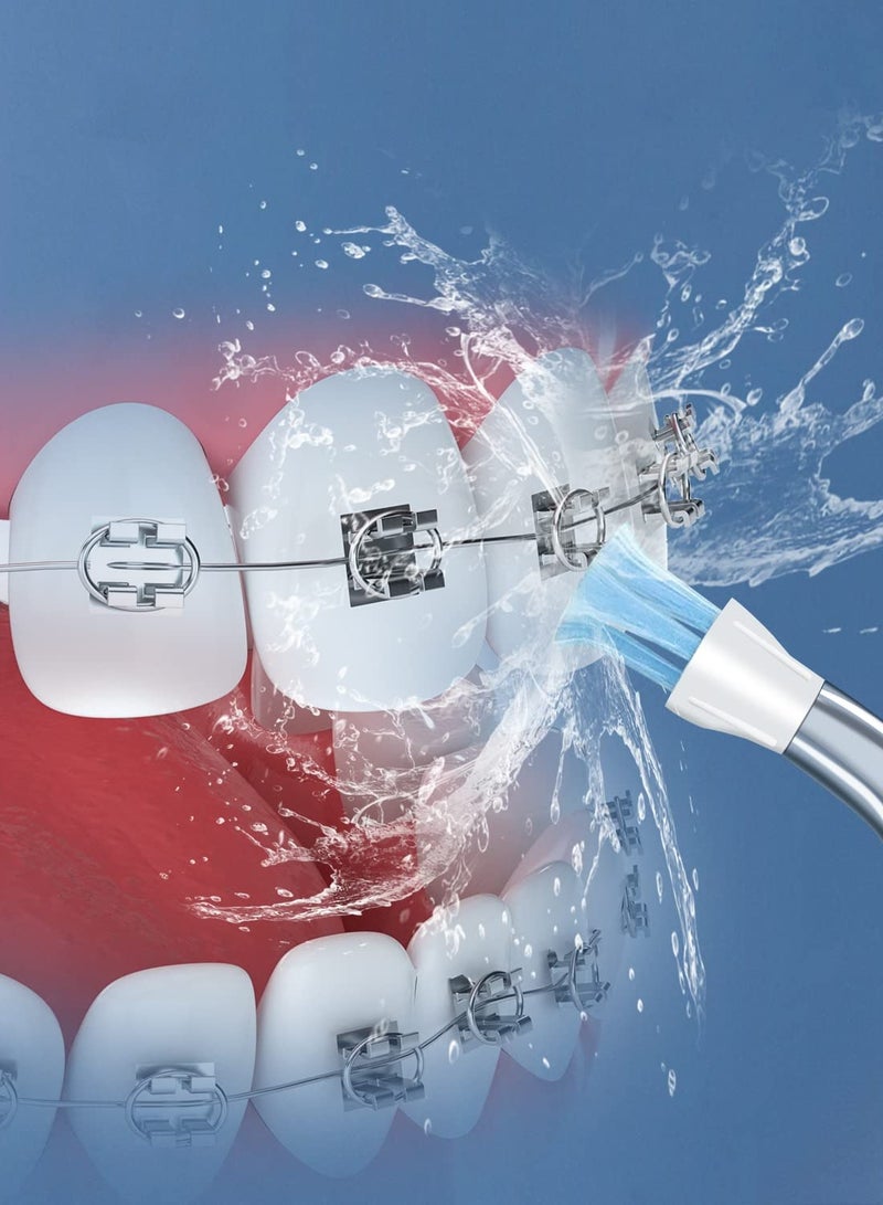 KASTWAVE أطراف بديلة لأدوات تنظيف الأسنان بالماء Waterpik Classic Jet Tips، لقطع غيار Waterpik وأجهزة الري الفموي الأخرى (6 أطراف AquaFlosser) - Image 4