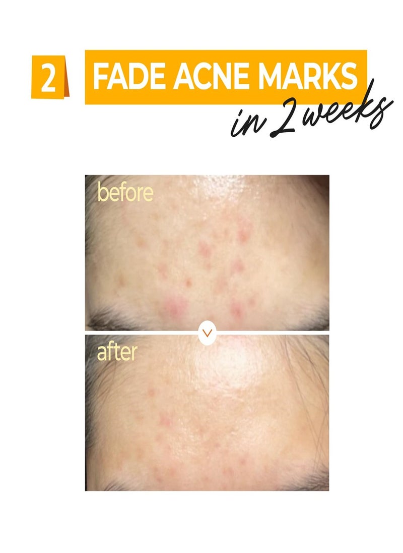 numbuzin - Numbuzin No.5+ Vitamin Concentrated Serum | Glutathione and Vitamin Serum, Dark Spot, Brightening,Korean Skincare,For All Skin Types 1.01fl.oz/30ml - Image 1