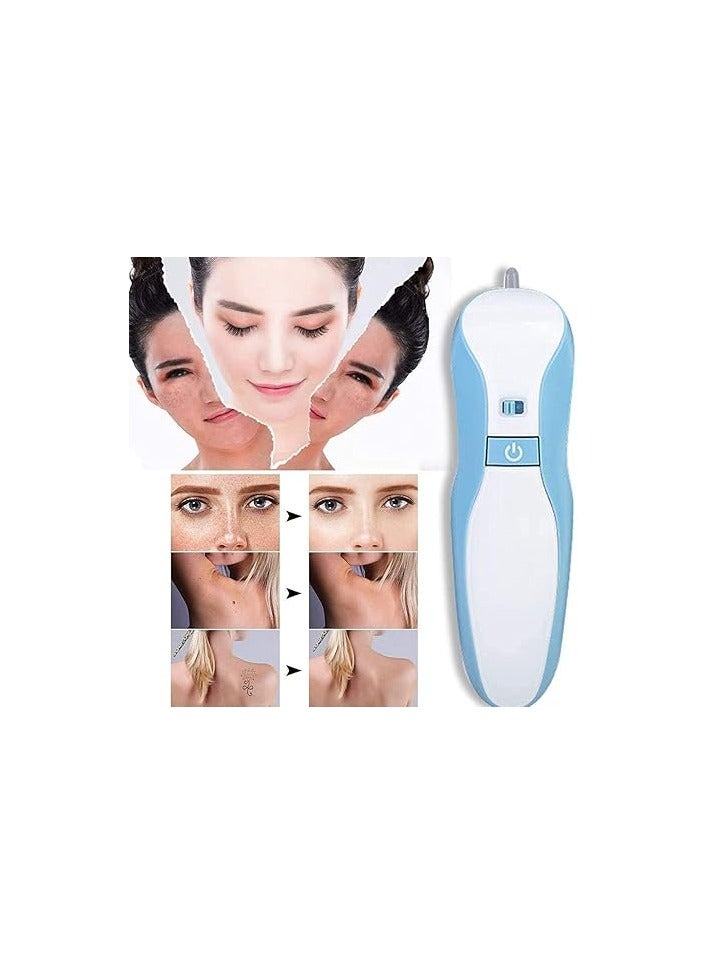 Generic YFD Professional Fibroblast Plasma Pen Mole Removal Pen Skin With 3 Adjustable Modes Portable Rechargeable For Remover Freckle Wrinkle Mole Tattoo Tattoomole Removal Machine  - Image 4