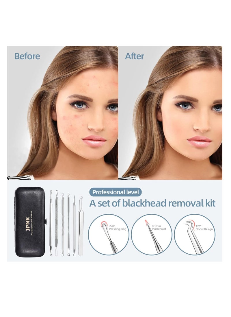 JPNK - JPNK Blackhead Remover Tool Comedones Extractor Acne Removal Kit for Blemish, Whitehead Popping, 6 Pcs Zit Removing for Nose Face Tools with a Leather Bag - Image 1
