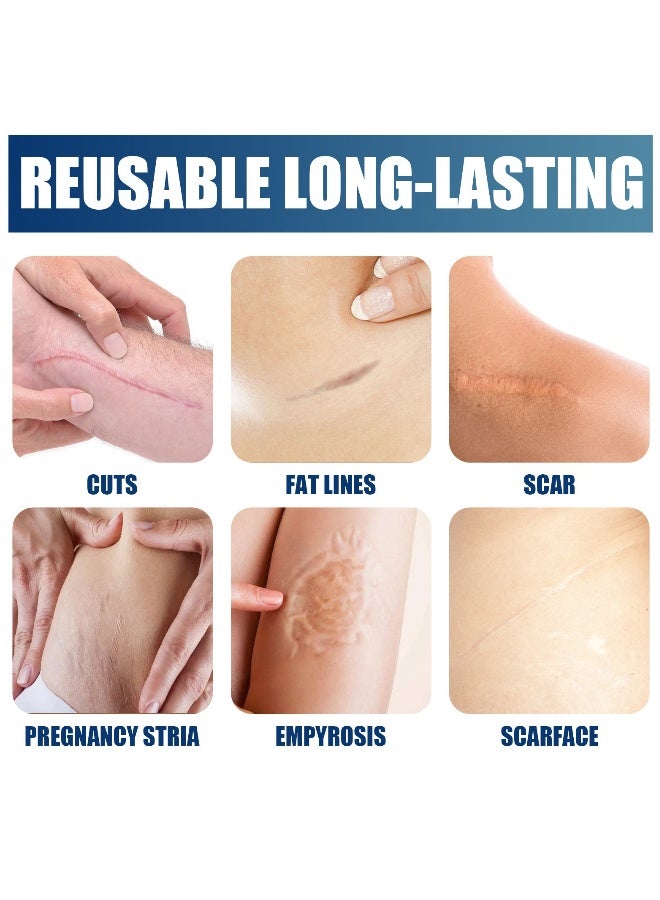 جايسوينغ جل السيليكون لعلاج الندبات 30 جرام، كريم إزالة الندبات، علاج الندبات، كريم لإزالة الندبات لعملية القيصرية، علامات التمدد، حب الشباب، الجراحة، فعال للندبات القديمة والجديدة - Image 4