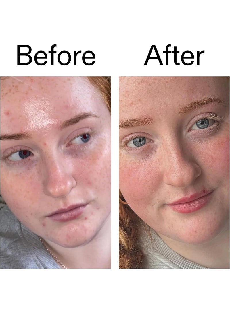 The Inkey List Vitamin B C And E Moisturizer - Image 4