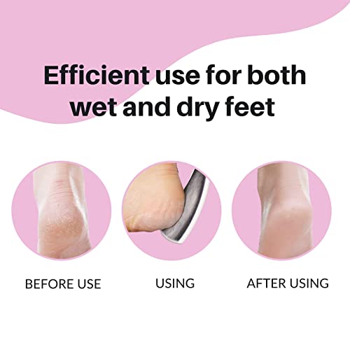 TRITON Emery Professional Dual Sided Foot Scraper, Filer for Hard and Dead Skin Callus Remover, Pedicure Foot Scrubber for Men and Women - Image 3