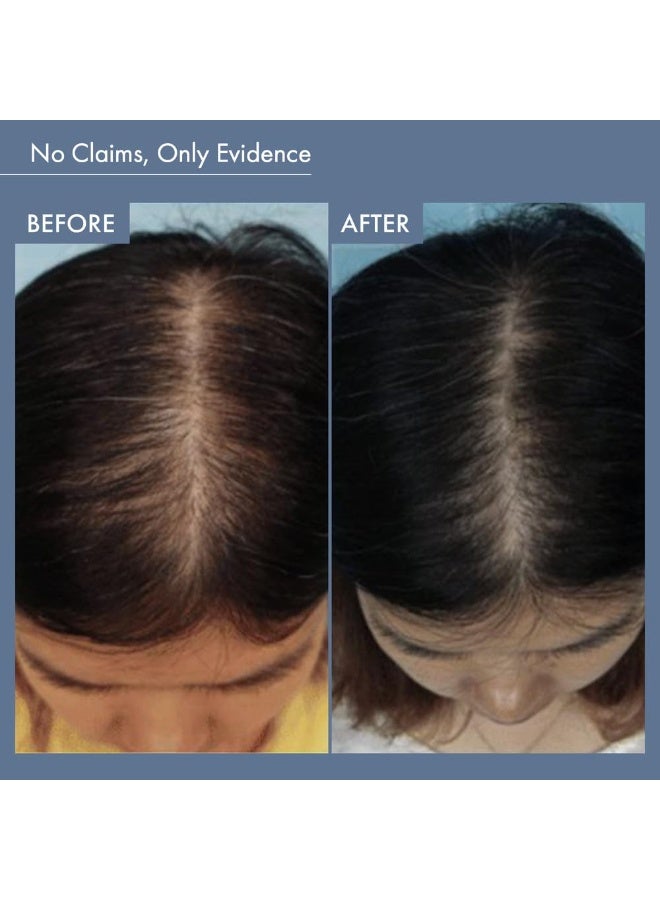 ثريفيكو شامبو روزماري من ثرايف كو لشعر كثيف وحيوي | يكثف الشعر ويحفز نموه | يعزز قوة الشعر بفضل تركيبة Hyaplex™ وببتيد البازلاء والكافيين للرجال والنساء (250 مل) - Image 3