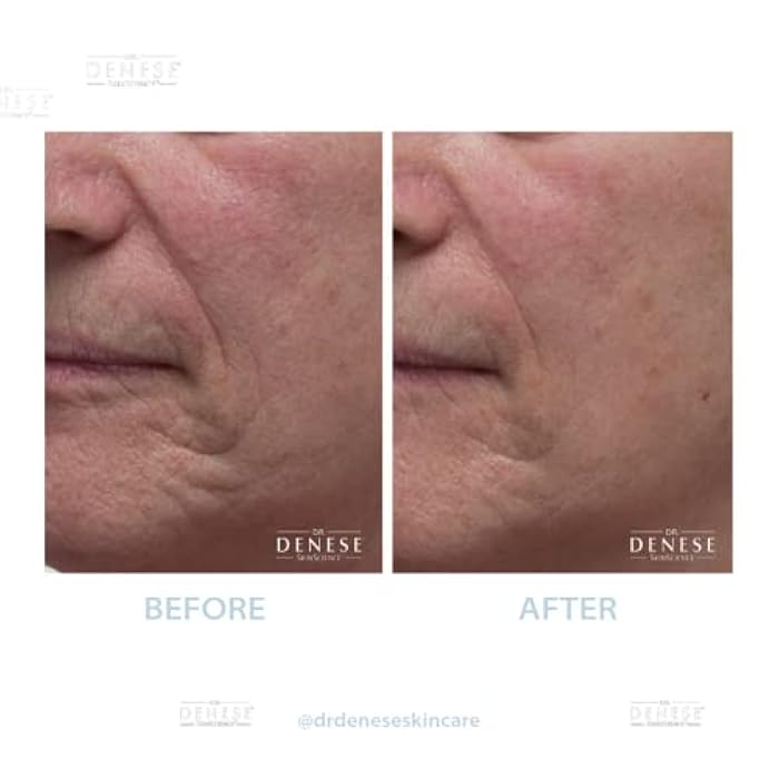 Dr. Denese Collagen Firming Peel Off Mask | 4 FL oz | A unique AHA based peel off mask designed to tighten the appearance of the skin - Image 4