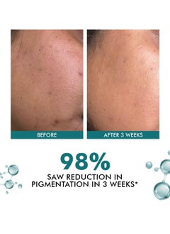 CONSCIOUS CHEMIST Kojic Acid Face Cream | 50g | Azelaic Acid Cream, Face Cream for Men & Women, Niacinamide & Tranexamic Acid, Anti Pigmentation Cream, Reduce Dark Spots, All Skin Type - Trubiom  - Image 2