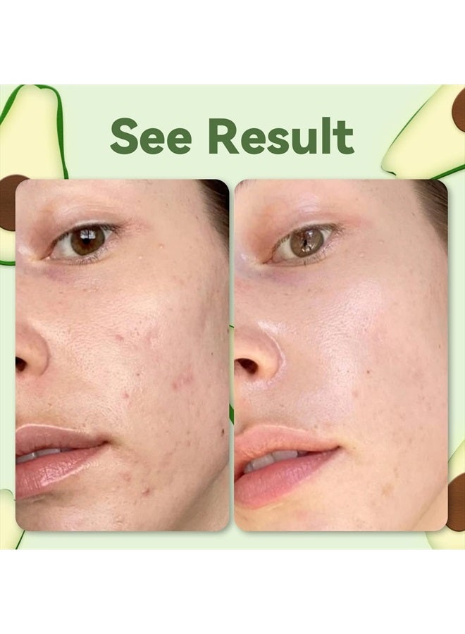 ANAI RUI Green Tea Face Mask with Avocado, Clay Facial Mask, Acne Detox Mask Skin Care, Deep Cleanse Mask, Hydrating, Nourishing, Soothing, 120g / 4.23 oz - Image 5