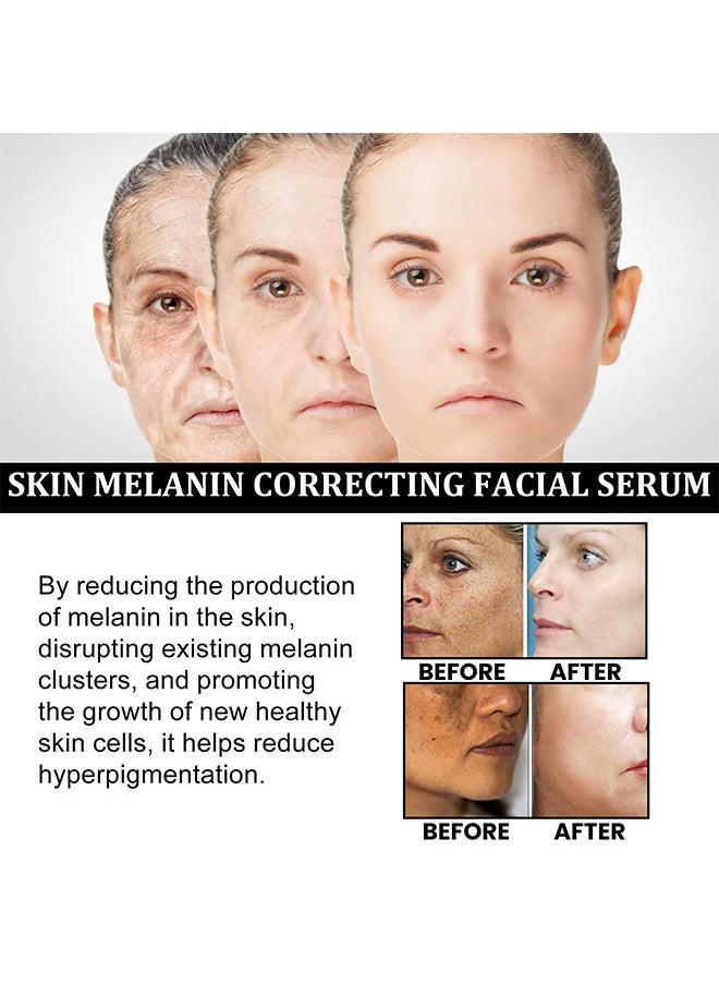 EELHOE Skin Melanin Correcting Facial Serum, Dark Spot Correcting Glow Serum, Mild and Not Stimulating for Any Part  - Image 3