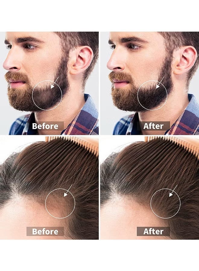 Hair Growth Roller, Beard Care Microneedle Roller, 540 Titanium Micro Needles Roller, 0.25mm Care Tool for Face & Neck Hair Growth, Body Wrinkles, Acne Scars and Stretch Marks, Home Beauty Device - Image 3