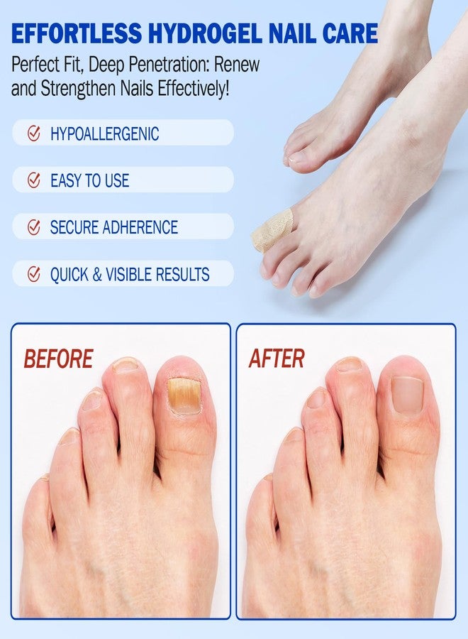 FANSHI Nail Patches 21 PCS, Toenail Treatment Extra Strength 8-Hour Overnight Nail Fast Acting Repair Effortless Hydrogel Nail Care and Repair for Damaged Nails Overnight Renewal for Men and Women - Image 4
