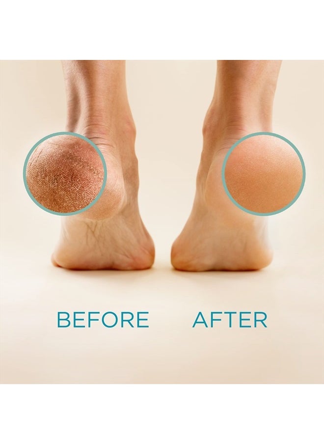Lee Beauty Professional - مزيل مسامير القدم الاحترافي من لي بيوتي - 236 مل، تركيبة أصلية قوية - جل قوي للغاية، نتائج سبا منزلية للباديكير للقدم - مستلزمات البشرة الجافة والمتشققة والميتة - Image 1