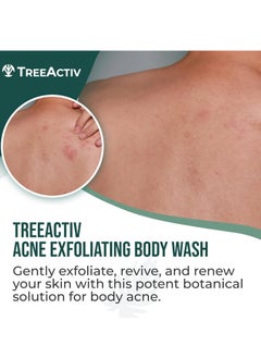 TreeActiv TreeActiv Exfoliating Acne Body Wash 8 fl oz Body Acne Wash for Back, Chest, Shoulder, Back Acne Treatment with Jojoba Beads, Back Acne Body Wash for Bacne, Soothing Body Acne Treatment for Men, Women  - Image 2