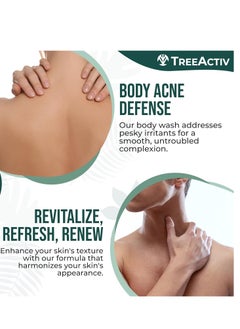 TreeActiv TreeActiv Exfoliating Acne Body Wash 8 fl oz Body Acne Wash for Back, Chest, Shoulder, Back Acne Treatment with Jojoba Beads, Back Acne Body Wash for Bacne, Soothing Body Acne Treatment for Men, Women  - Image 5