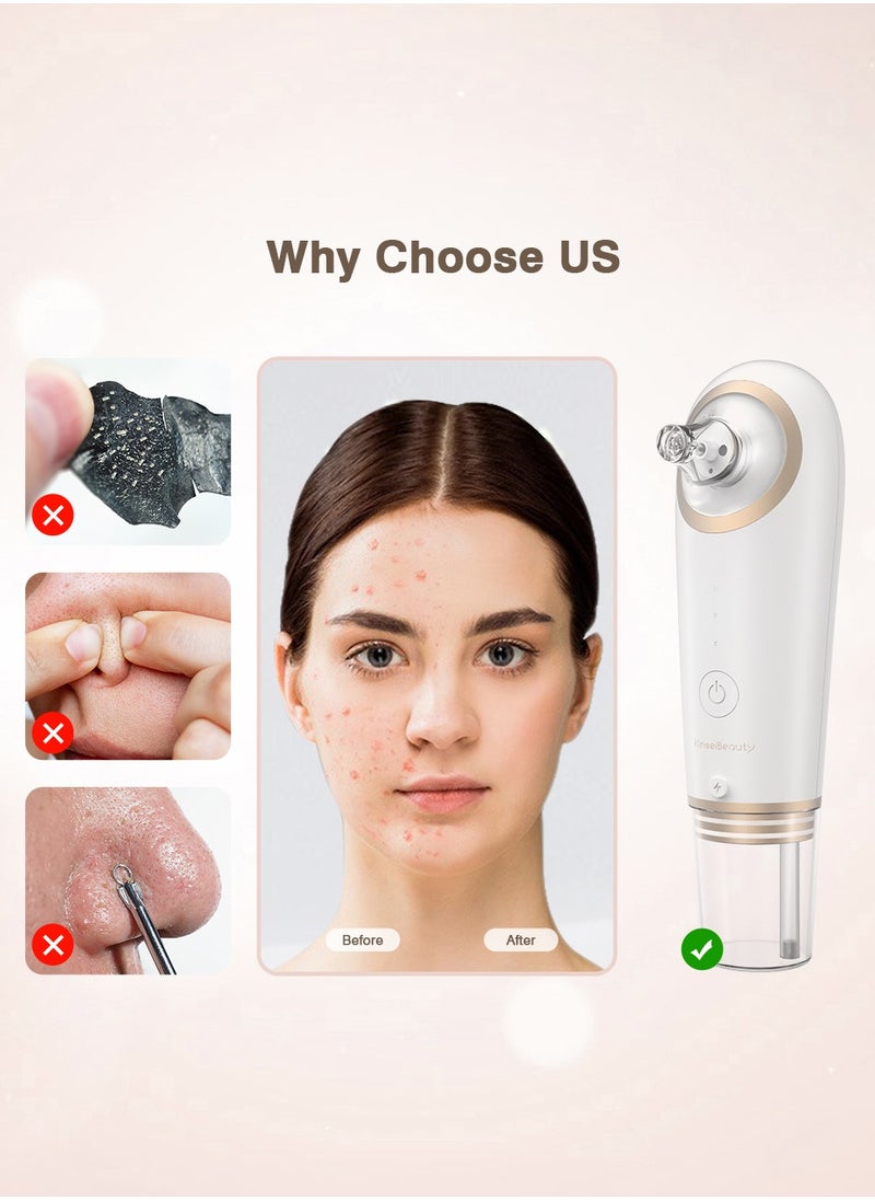 KinseiBeauty - Blackhead Remover Vacuum, Facial Pore Cleaner, Electric Acne Comedone Extraction Whitehead Blackhead Tool with 4 Removable Suction Head for Women - Image 1