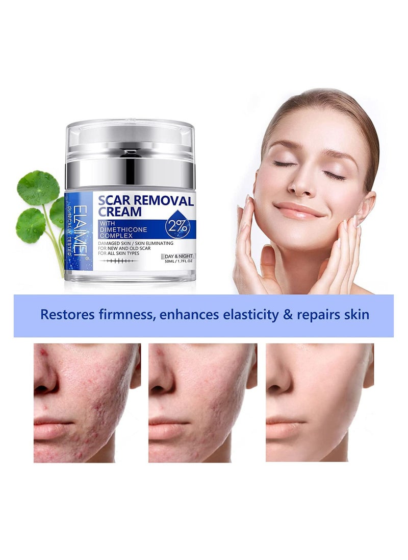 Elaimei - Scar And Stretch Mark Removal Cream For With Dimethicone Complex Added 100% Retinol Free Scar From Damaged Skin & New + Old Scar Removal Treatment Natural Skin Repairing Factors Unisex (50ml) - Image 1