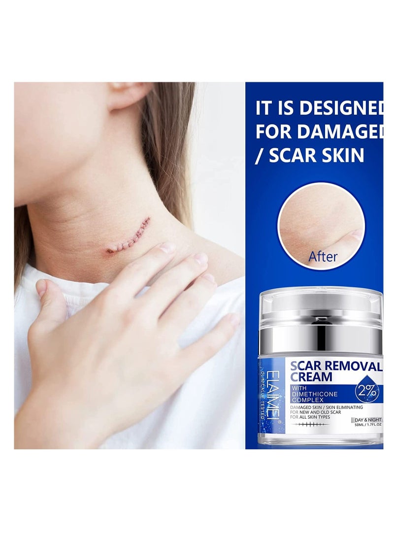 Elaimei - Scar And Stretch Mark Removal Cream For With Dimethicone Complex Added 100% Retinol Free Scar From Damaged Skin & New + Old Scar Removal Treatment Natural Skin Repairing Factors Unisex (50ml) - Image 1