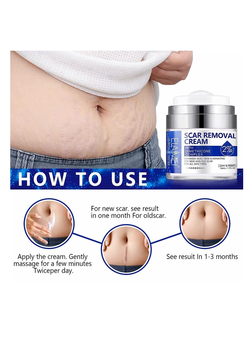 Elaimei - Scar And Stretch Mark Removal Cream For With Dimethicone Complex Added 100% Retinol Free Scar From Damaged Skin & New + Old Scar Removal Treatment Natural Skin Repairing Factors Unisex (50ml) - Image 1