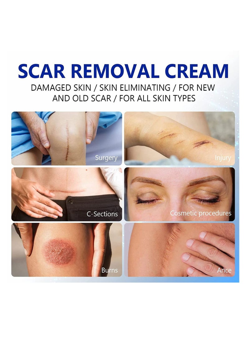 Elaimei - Scar And Stretch Mark Removal Cream For With Dimethicone Complex Added 100% Retinol Free Scar From Damaged Skin & New + Old Scar Removal Treatment Natural Skin Repairing Factors Unisex (50ml) - Image 1