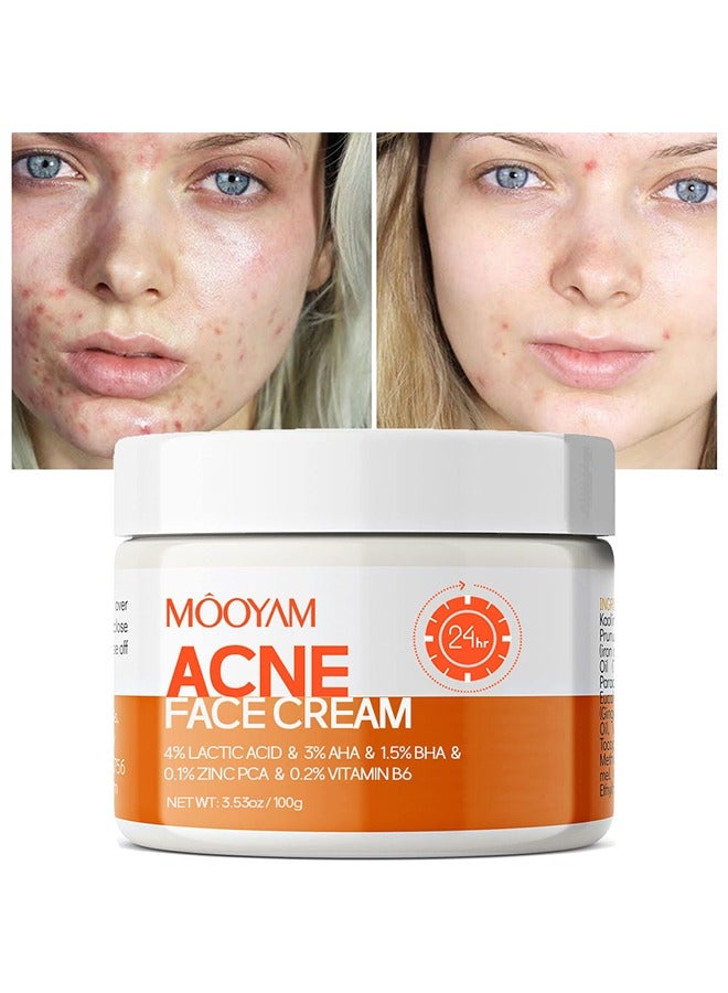 MOOYAM Acne Face Cream, Acne Spot Treatment for Face and Acne Dots, Natural Cystic Acne Treatment, For All Skin Types, Premium Acne Scar Cream and Pimple Remover 30g  - Image 1