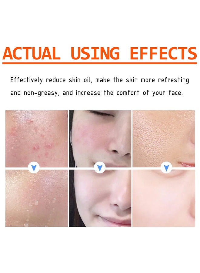 MOOYAM Acne Face Cream, Acne Spot Treatment for Face and Acne Dots, Natural Cystic Acne Treatment, For All Skin Types, Premium Acne Scar Cream and Pimple Remover 30g  - Image 5