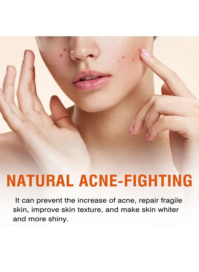 MOOYAM Acne Face Cream, Acne Spot Treatment for Face and Acne Dots, Natural Cystic Acne Treatment, For All Skin Types, Premium Acne Scar Cream and Pimple Remover 30g  - Image 3