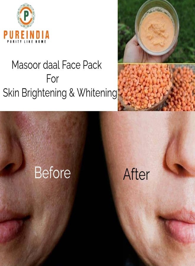 PureIndia Masoor daal Face Mask-100 Gm, All Skin Type For Radiant Skin,Brightening & Removes- Dark Spots,Acne,Pimples, Blemishes. For Men & Women. 100% Masoor daal. By- PUREINDIA - Image 2