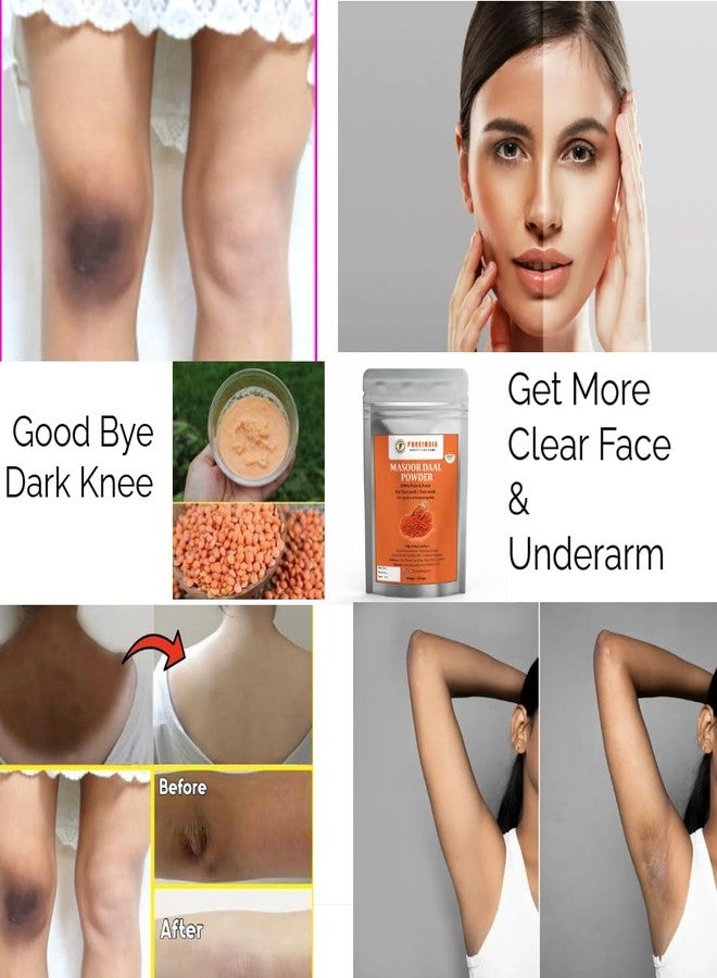 PureIndia Masoor daal Face Mask-100 Gm, All Skin Type For Radiant Skin,Brightening & Removes- Dark Spots,Acne,Pimples, Blemishes. For Men & Women. 100% Masoor daal. By- PUREINDIA - Image 3