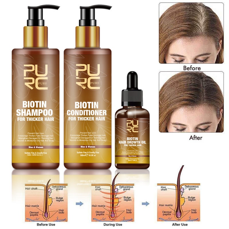 Purc Hair Care Ginger Biotin Three-Piece Set Shampoo Conditioner Repair Dry and Frizzy Essential Oil(Conditioner 300ml) - Image 2