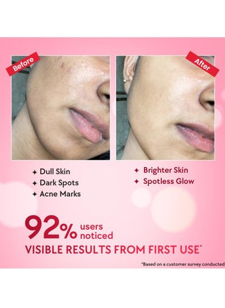 CHICNUTRIX Treatment & Serums UAE | 30-75% OFF